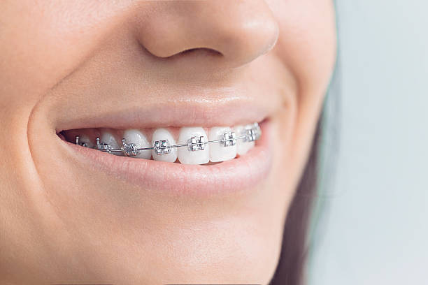 Best Dentures (Full and Partial)  in Grape Creek, TX
